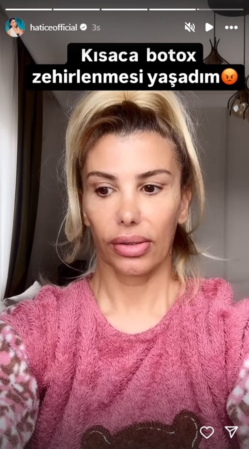 Şarkıcı Hatice Botox Zehirlenme Deneyimi: En son sürümü paylaştı - 2